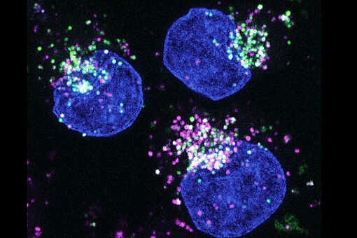 Немецкие онкологи обнаружили у раковых клеток ген для выживания без "пищи"